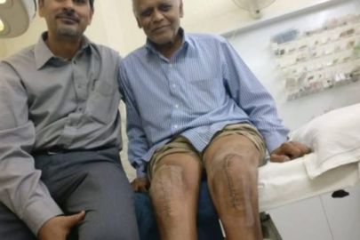 total knee surgery in indore