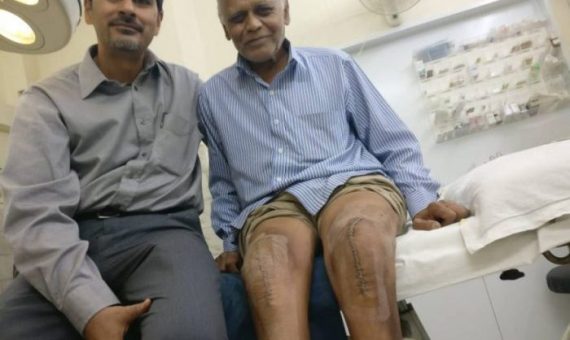 total knee surgery in indore