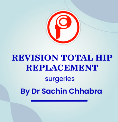 Revision Total Hip Replacement Surgeries by Dr Sachin Chhabra